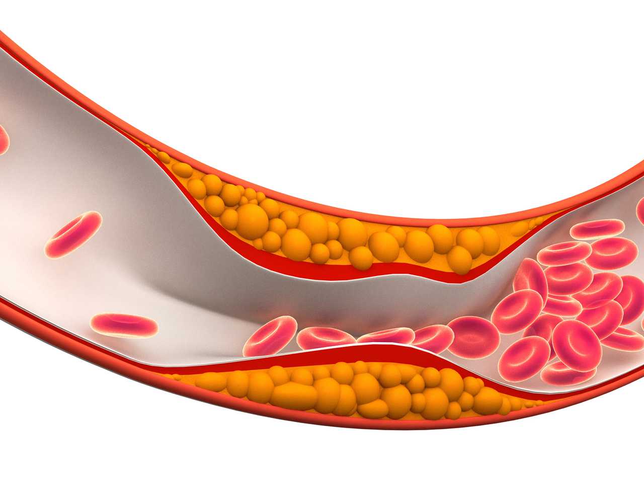 Kolesterol kalp damar üzerine etkisi